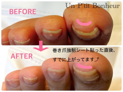 アンプティボヌール(Un P'tit Bonheur)の写真