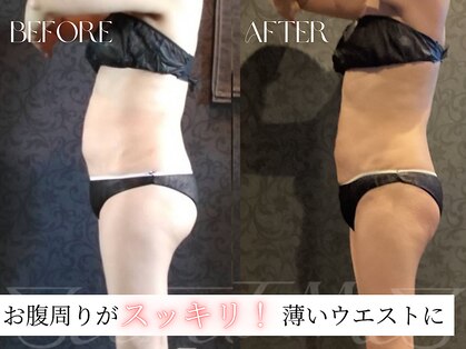 ビースト 下北沢店(B-st.)の写真