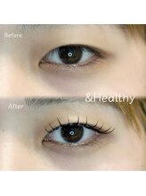 リッチオ(Riccio)/アンドヘルシー