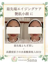 ヨサパーク サーナ 仙川(YOSA PARK Sana)/40代お客様ビフォーアフター