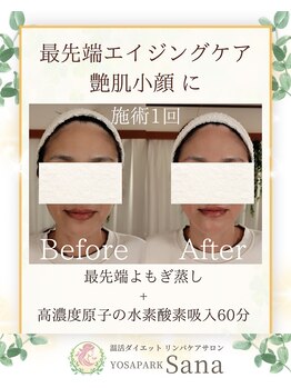 ヨサパーク サーナ 仙川(YOSA PARK Sana)/40代お客様ビフォーアフター