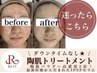 【リピーター様】REVI最高峰ケア☆ハーブピーリング＋IPSP美容液導入でハリ艶