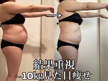 ヨサパーク ラナ(YOSA PARK Lana)の雰囲気（しっかり詰めて通えば、驚きの変化に感動！！）