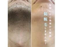 脱毛専門サロン エリクサー(Elixir)の雰囲気（圧倒的人気No.1♪リピート率98%のヒゲ脱毛！）