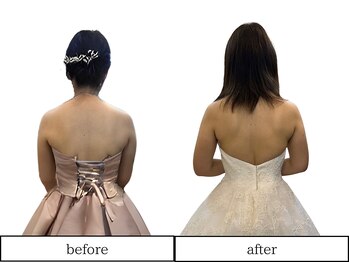 エムズ 八尾久宝寺店/整体ビフォーアフター