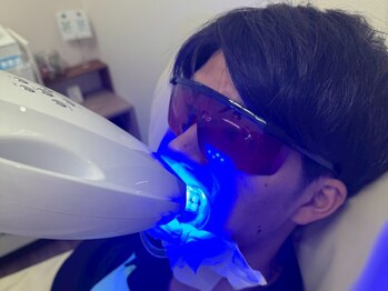 ファイブ トゥー(Five Two)の写真/【セルフホワイトニング初回お試し1回¥1000】歯の黄ばみを撃退し印象UP◎丁寧なカウンセリング付きで安心♪
