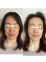 モモラ(Spa MoMora)/肌色！美白！美肌！港区白金台