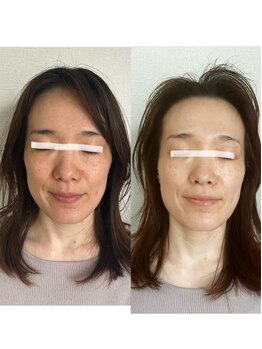 モモラ(Spa MoMora)/肌色！美白！美肌！港区白金台