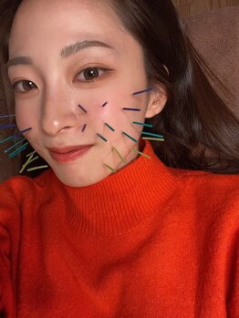 ハリトマト 梅田中崎/施術(肌質・浮腫)