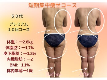 ヨサパーク リボーン(YOSA PARK Reborn)/劇的ビフォーアフター/痩身駒込