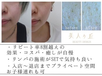 美人ヶ丘 長野店/長野,小顔矯正,マッサージ