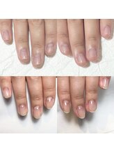 キュア(Cure.)/綺麗な縦長の爪に!!