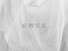 ヴェリス 新宿店(Velisse)/症例
