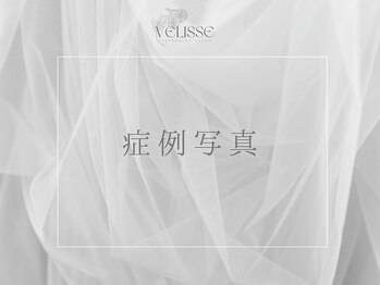 ヴェリス 新宿店(Velisse)/症例