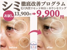 スイッチ(Switch)の雰囲気（肌解析機による肌チェック＆カウンセリングが肌改善の近道です）