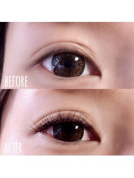 ルプラス(LUPLUS)/◆Before/After◆