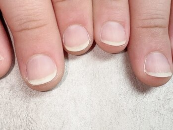 フィーノ ネイル(fino nail)の写真/「フィルイン」「育爪コース」でお手元にコンプレックスがある方も、爪の形成から圧倒的美仕上げにー。