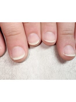 爪の悩みを解消できる（ケア含む）