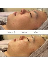 ビーエヌ エステティックアンドスパ(BN Esthetic&Spa)/男性もムルトクスですっきり♪