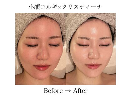 ミベル(MeBell)の写真