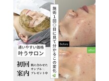 エレ(ele)