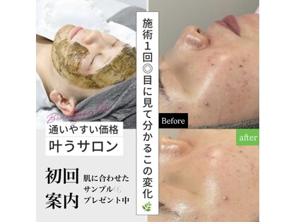 エレ(ele)の写真