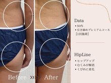 ヨサパーク すずのね(YOSA PARK)/深部リンパを流して１回の効果！