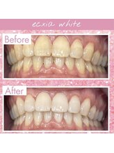 エクシアホワイト 長野店/