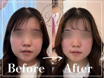 R-1ビューティーサロン 表参道/Before＆After