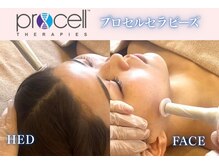 ミレット(Miretto)の雰囲気（ダウンタイムないマイクロニードル。施術翌日からメイク可）