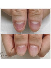サラ(Sarah.)/深爪ケアメニュー