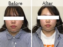 ハリラウンジ 恵比寿本店(Hari Lounge)/美容鍼専門サロン Hari Lounge