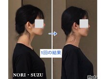 ノリスズ(NORI SUZU)の雰囲気（ストレートネック/スマホ首/猫背/前肩/反り腰/ポッコリお腹/小顔）