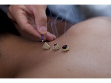 東洋はり灸院 大津石山院/鍼とお灸について