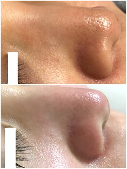 ヒルナム(Heal Nam)/~プロセルセラピーズ~フェイス