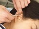 辻鍼灸接骨院の写真/今話題の耳つぼがお手軽な金額で体験ができる◎耳つぼを刺激してお顔や身体のお悩みを改善！