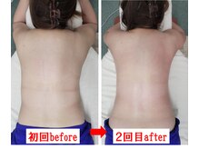 いちのま整骨院の雰囲気(筋膜リリース(メディセル))