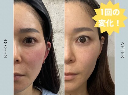 ラプティット(La petite)の写真