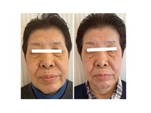 アイビー(aibe:)/70代でも変わります！