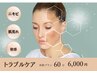 【ニキビケア/肌荒れ/黒ずみ/敏感肌】トラブルケア★60分6000円