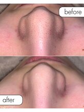 サロン ド カスケード(Salon de Cascade)/20代女性