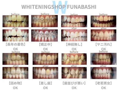 セルフホワイトニング専門店　 ホワイトニングショップ船橋2号店【ホワイトニング】の写真