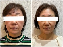 美容整体ウェリナ あま甚目寺院/小顔矯正/骨盤矯正/美脚サロン