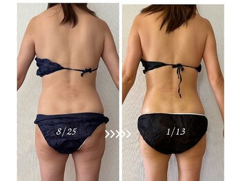 アイリーボーテ 東大阪(アイリーBEAUTE)/痩身