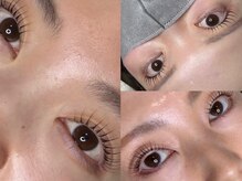 エーラッシュ(A-Lash)