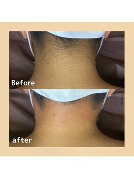 スウィートマジョラム(Sweet Marjoram)/うなじワックス