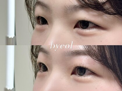 ビョル(byeol)の写真