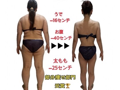 サロンドシェリ エステ(Salon de cheri)の写真