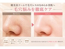 トータルヘルスビューティーカズ(TotalHealthBeauty KAZU)/【肌質改善】光の森/光美容