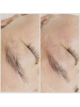 ルアナ(Luana)/メンズも眉毛wax♪